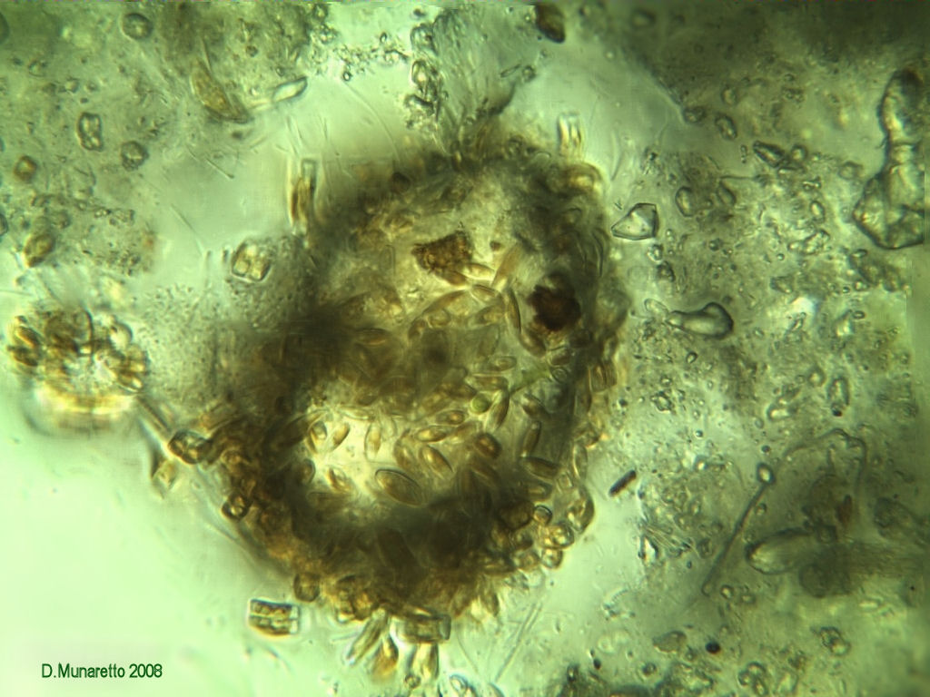 ...TECAMEBA di cristallo e diatomee!